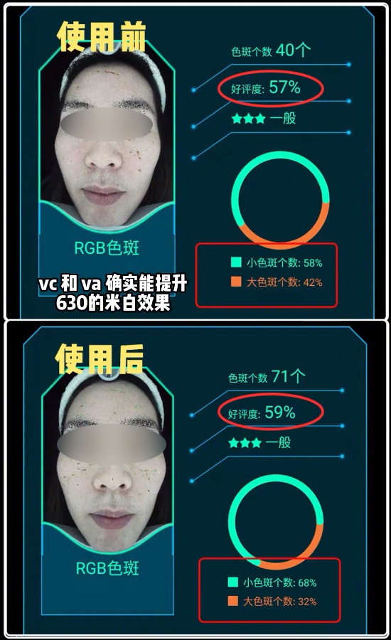 妮维雅630淡斑精华使用前使用后对比图